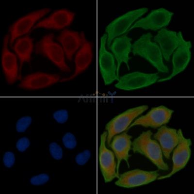 Hexokinase 1 Antibody - DF3112 staining Hela cells(30min of UV treatment) by IF/ICC.
