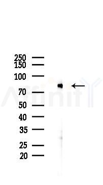 TNF Receptor II Antibody - Western blot analysis of lysates from PC12 cells(LPS 4h treatment), using TNF Receptor II Antibody at 1/1000 dilution.
