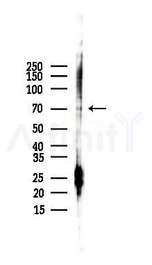 p70 S6 Kinase Antibody - Western blot analysis of lysates from Mouse liver, using p70 S6 Kinase Antibody at 1/1000 dilution.