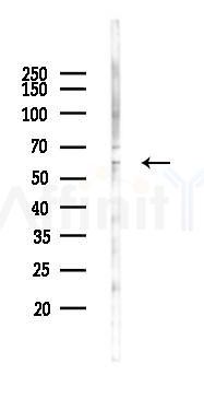 CORO1A Antibody - Western blot analysis of lysates from 293 cells(LPS 4h treatment), using CORO1A Antibody at 1/1000 dilution.