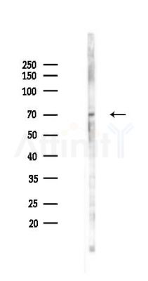 RORA Antibody - Western blot analysis of lysates from K562 cells(starvation 24h treatment), using RORA Antibody at 1/1000 dilution.