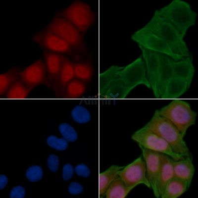 ETV6 / Tel Antibody - DF3174 staining Hela cells(24h of starvation treatment) by IF/ICC.