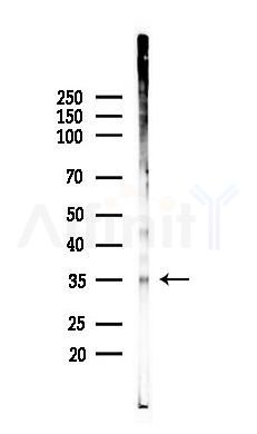 PRKAG1/2/3 Antibody - Western blot analysis of lysates from Mouse lung, using PRKAG1/2/3 Antibody at 1/1000 dilution.