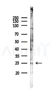 SRY Antibody - Western blot analysis of lysates from RAW264.