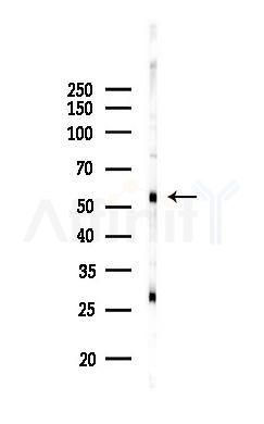 SFRS4 Antibody - Western blot analysis of lysates from Rat brain, using SFRS4 Antibody at 1/1000 dilution.