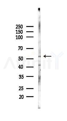 NAB2 Antibody - Western blot analysis of lysates from Mouse lung, using NAB2 Antibody at 1/1000 dilution.