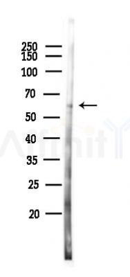 ZNF596 Antibody - Western blot analysis of lysates from Hela cells(LPS 4h treatment), using ZNF596 Antibody at 1/1000 dilution.