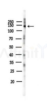 AKAP1 Antibody - Western blot analysis of lysates from Hela cells(LPS 4h treatment), using AKAP1 Antibody at 1/1000 dilution.