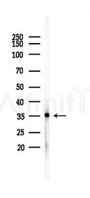 AKAP1 Antibody - Western blot analysis of lysates from Rat liver, using AKAP1 Antibody at 1/1000 dilution.