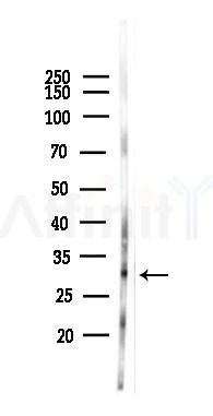 AKAP1 Antibody - Western blot analysis of lysates from PC12 cells(LPS 4h treatment), using AKAP1 Antibody at 1/1000 dilution.