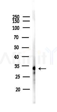 AKAP1 Antibody - Western blot analysis of lysates from Hela cells(LPS 4h treatment), using AKAP1 Antibody at 1/1000 dilution.