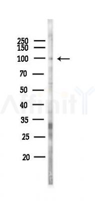 MASTL Antibody - Western blot analysis of lysates from Hela cells(LPS 4h treatment), using MASTL Antibody at 1/1000 dilution.