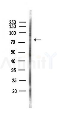 ATF6B Antibody - Western blot analysis of lysates from PC12 cells(LPS 4h treatment), using ATF6B Antibody at 1/1000 dilution.