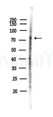 ATF6B Antibody - Western blot analysis of lysates from Hela cells(LPS 4h treatment), using ATF6B Antibody at 1/1000 dilution.