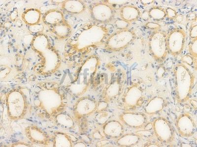 MARK1/2/3/4 Antibody - DF3457 at 1/100 staining human normal kidney tissue by IHC-P.