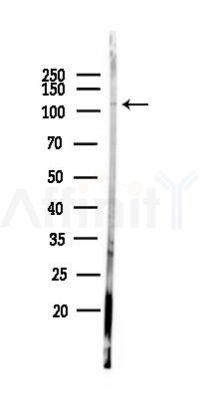 HMG20B Antibody - Western blot analysis of lysates from PC12 cells(LPS 4h treatment), using HMG20B Antibody at 1/1000 dilution.