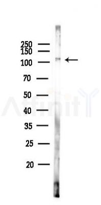 HMG20B Antibody - Western blot analysis of lysates from Hela cells(LPS 4h treatment), using HMG20B Antibody at 1/1000 dilution.