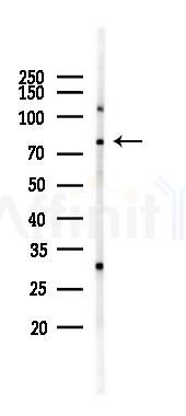 DBF4 Antibody - Western blot analysis of lysates from K562 cells(UV 30min treatment), using DBF4 Antibody at 1/1000 dilution.