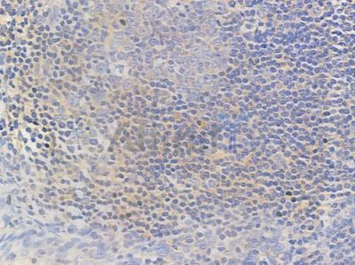 Mlx Antibody - DF3466 at 1/100 staining human normal tonsil tissue by IHC-P.