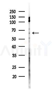 IKZF3 Antibody - Western blot analysis of lysates from PC12 cells(LPS 4h treatment), using IKZF3 Antibody at 1/1000 dilution.