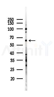 IKZF3 Antibody - Western blot analysis of lysates from K562 cells(UV 30min treatment), using IKZF3 Antibody at 1/1000 dilution.