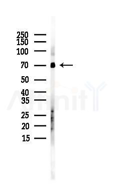 IKZF3 Antibody - Western blot analysis of lysates from Mouse liver, using IKZF3 Antibody at 1/1000 dilution.