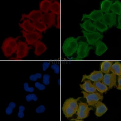 14-3-3 theta Antibody - DF3494 staining Hela cells(30min of UV treatment) by IF/ICC.