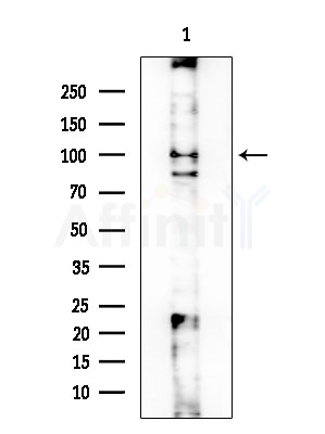 ADD2 Antibody - Western blot analysis of lysates from COLO205 cells, using ADD2 Antibody at 1/1000 dilution.