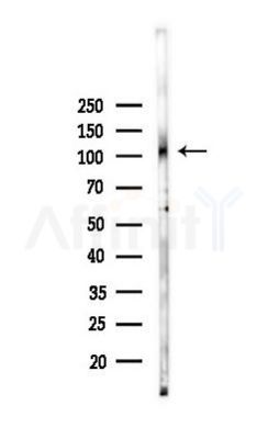 ADD2 Antibody - Western blot analysis of lysates from K562 cells(heat-shock 45min treatment), using ADD2 Antibody at 1/1000 dilution.