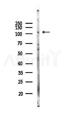 ADD2 Antibody - Western blot analysis of lysates from COLO205 cells(heat-shock 45min treatment), using ADD2 Antibody at 1/1000 dilution.