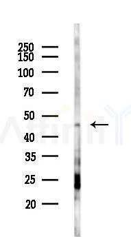 ADRB2 Antibody - Western blot analysis of lysates from COLO205 cells(starvation 24h treatment), using ADRB2 Antibody at 1/1000 dilution.