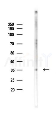 AIM2 Antibody - Western blot analysis of lysates from B16F10-LUC cells(starvation 24h treatment), using AIM2 Antibody at 1/1000 dilution.