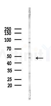 CADM4 Antibody - Western blot analysis of lysates from PC12 cells(LPS 4h treatment), using CADM4 Antibody at 1/1000 dilution.