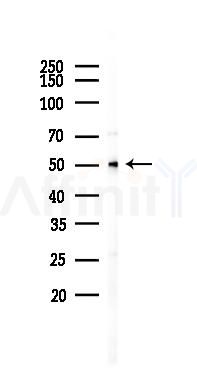 Cytochrome P450 17A1 Antibody - Western blot analysis of lysates from K562 cells(UV 30min treatment), using Cytochrome P450 17A1 Antibody at 1/1000 dilution.