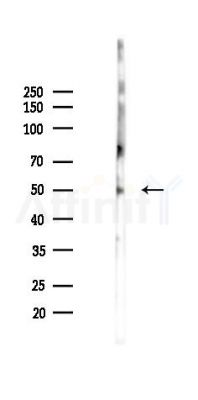 Cytochrome P450 2A6 Antibody - Western blot analysis of lysates from K562 cells(starvation 24h treatment), using Cytochrome P450 2A6 Antibody at 1/1000 dilution.