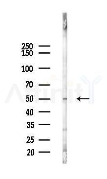 Cytochrome P450 3A4 Antibody - Western blot analysis of lysates from 293 cells(LPS 4h treatment), using Cytochrome P450 3A4 Antibody at 1/1000 dilution.