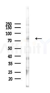BARD1 Antibody - Western blot analysis of lysates from K562 cells(heat-shock 45min treatment), using BARD1 Antibody at 1/1000 dilution.