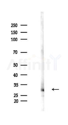 BCL10 Antibody - Western blot analysis of lysates from Rat liver, using BCL10 Antibody at 1/1000 dilution.