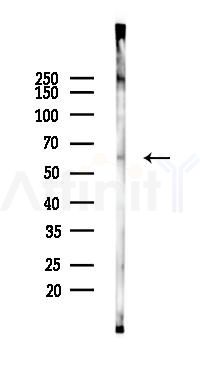 ELOA3 Antibody - Western blot analysis of lysates from K562 cells(heat-shock 45min treatment), using ELOA3 Antibody at 1/1000 dilution.