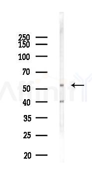 PRPF19 Antibody - Western blot analysis of lysates from 293 cells(LPS 4h treatment), using PRPF19 Antibody at 1/1000 dilution.