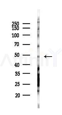 RAD23A Antibody - Western blot analysis of lysates from COLO205 cells(starvation 24h treatment), using RAD23A Antibody at 1/1000 dilution.