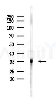 MRPL15 Antibody - Western blot analysis of lysates from K562 cells(heat-shock 45min treatment), using MRPL15 Antibody at 1/1000 dilution.