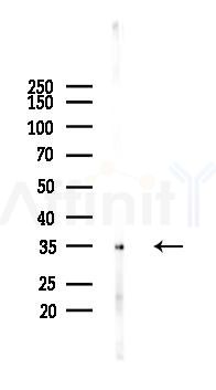 MRPL15 Antibody - Western blot analysis of lysates from PC12 cells(LPS 4h treatment), using MRPL15 Antibody at 1/1000 dilution.