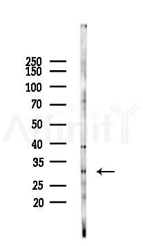 MRPL9 Antibody - Western blot analysis of lysates from PC12 cells(LPS 4h treatment), using MRPL9 Antibody at 1/1000 dilution.