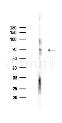 TROVE2 Antibody - Western blot analysis of lysates from K562 cells(starvation 24h treatment), using TROVE2 Antibody at 1/1000 dilution.