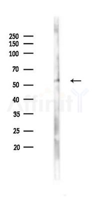 TROVE2 Antibody - Western blot analysis of lysates from B16F10-LUC cells(starvation 24h treatment), using TROVE2 Antibody at 1/1000 dilution.