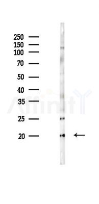 RPL12 Antibody - Western blot analysis of lysates from Hela cells(UV 30min treatment), using RPL12 Antibody at 1/1000 dilution.