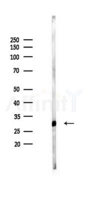 ABHD14A Antibody - Western blot analysis of lysates from Mouse liver, using ABHD14A Antibody at 1/1000 dilution.