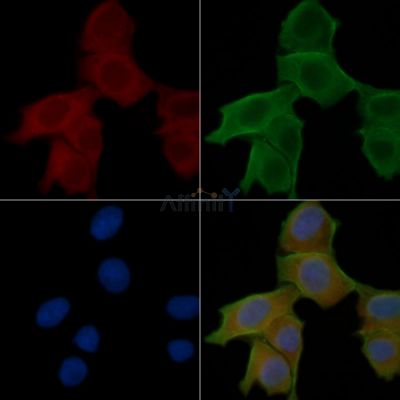 CHRNB1 Antibody - DF3724 staining Hela cells(24h of starvation treatment) by IF/ICC.