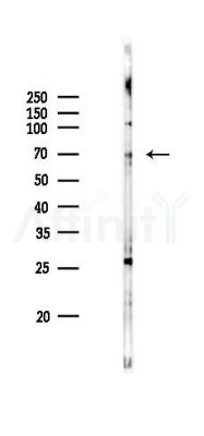 ACSS1 Antibody - Western blot analysis of lysates from RAW264.